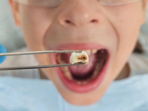 Best Weekend Emergency Dentist in Carpendale, WV